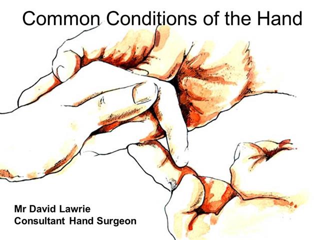 Common conditions of the Hand