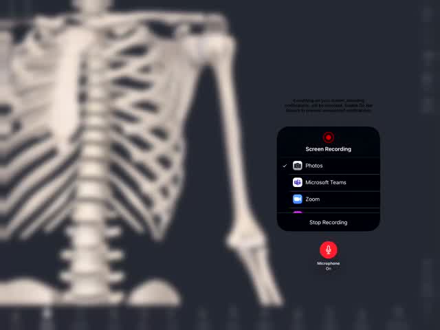 The HUMERUS