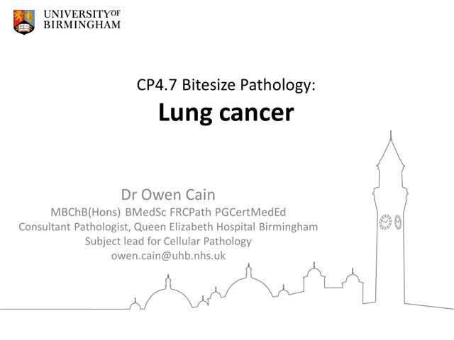 CP4.7 Lung cancer