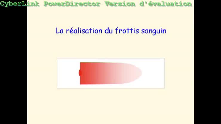 Présentation Frottis sanguin